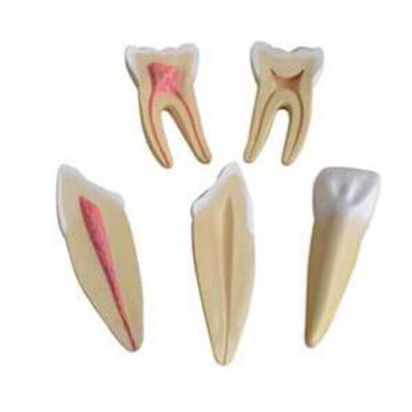 Modèle de 3 dents